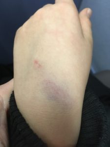 Bullying at Bristol School