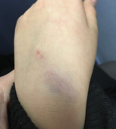 Bullying at Bristol School