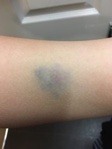 Bullying at Bristol School