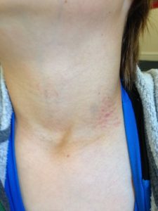 Bullying at Bristol School