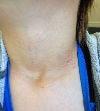 Bullying at Bristol School